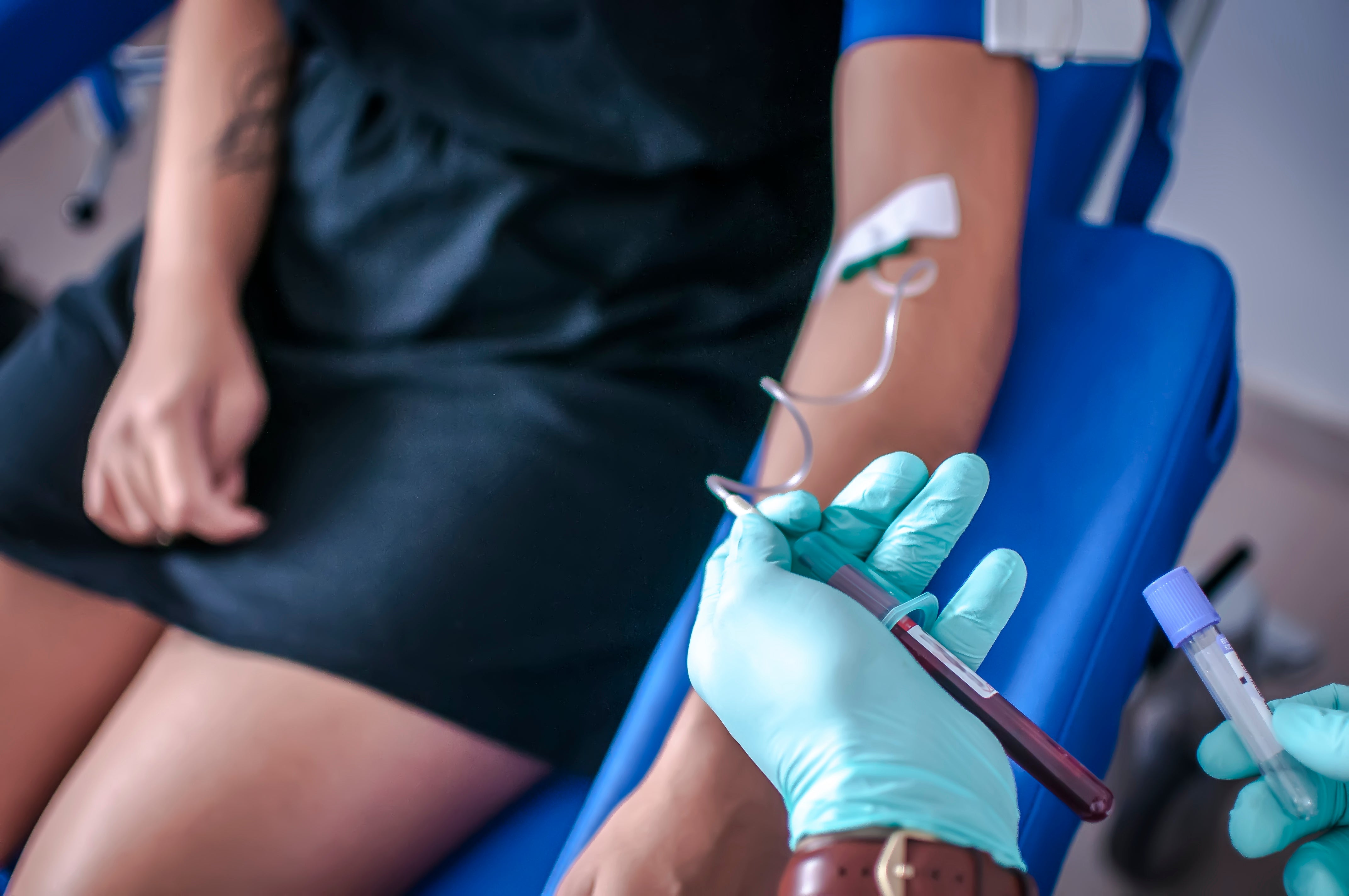 Nurse collecting arterial blood sample for ABG analysis from patient's arm using sterile techniqu